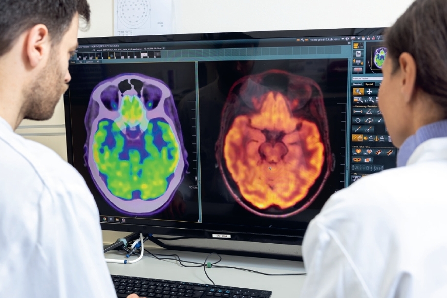 30 Jahre Epilepsiechirurgie am EZBB